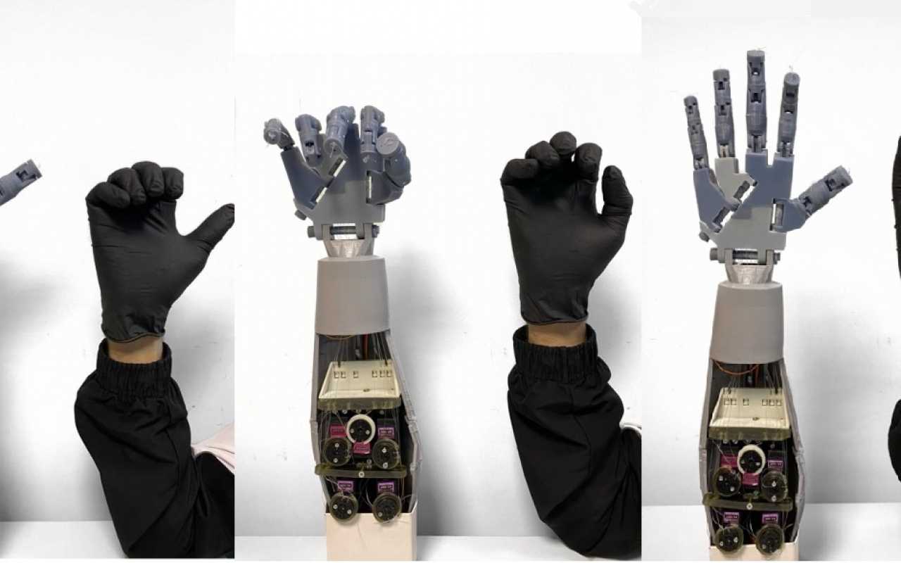 Ученые ЛЭТИ разработали «умную» перчатку для проведения высокоточных медицинских операций